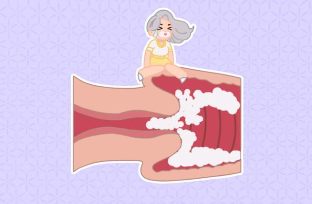 霉菌性阴道炎是什么引起的?如何治疗?