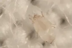 如何科学祛除被窝里的螨虫？3个小妙招送你图片