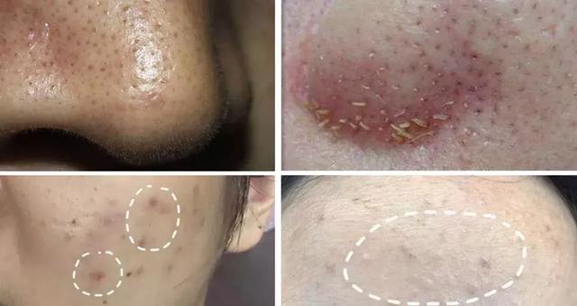 直播洗脸竟成了明星抢流量的绝招！氨基酸泡泡洁面，素颜更自信