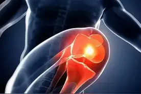 不穿秋裤就会得“老寒腿”、骨关节炎？让医生告诉你其中的原因图片