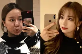为什么女孩子出门坚持化妆？看完这前后差，我彻底知道遮瑕的重要图片