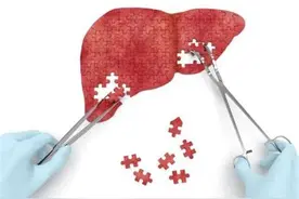 乙肝严不严重，不是看表面抗原和病毒DNA：你需要了解这些检查图片
