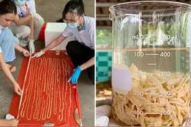 泰国男子爱吃生牛肉，体内取出18米长寄生虫，还有28颗虫卵图片