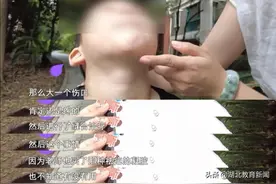 教育新视听丨幼儿园卫生间摔倒三次，最后一次留疤，家长索要祛疤费遇困难……图片