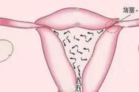 “生命之路”通不通 这项检查告诉你图片