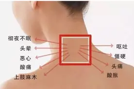 记忆枕、颈椎枕对颈椎病真的有效果吗？图片