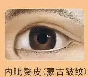 蒙古褶是啥？宝宝长了蒙古褶眼睛就会不好看吗？妈妈快来看看吧