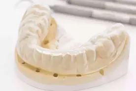 网上几百块钱就能整牙？矫正这么简单，医院为什么那么贵？图片