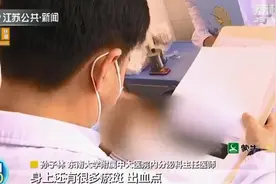 南京：糖尿病老人迷信“偏方”吃出一身病 激素水平失调后果严重图片