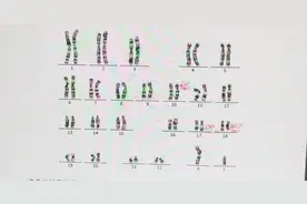 什么是染色体病？图片