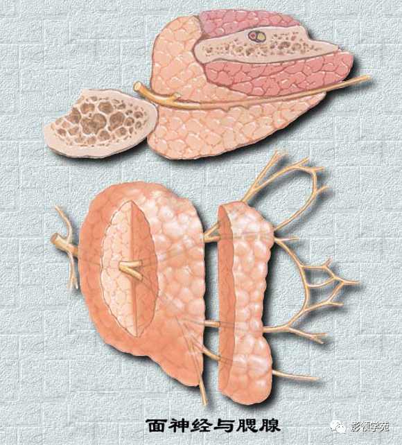 腮腺角化型鳞癌