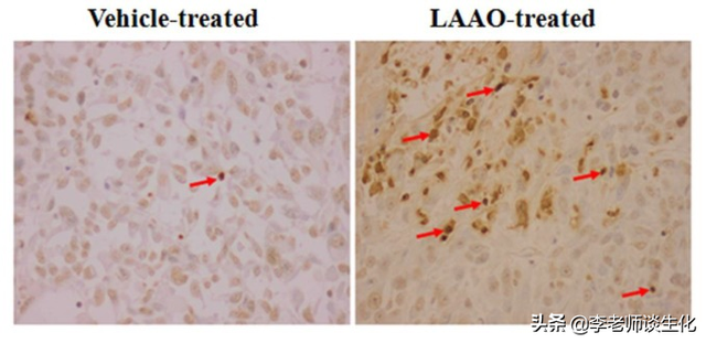 氨基酸的脱氨与氨基酸氧化酶