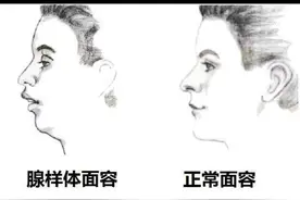 如果你的孩子也爱张嘴呼吸就看看吧图片