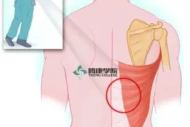 背阔肌综合征的发生机制与诊疗图片