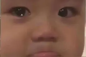 痘痘去了，痘印痘坑不管了？图片