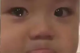 痘痘去了，痘印痘坑不管了？图片