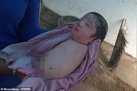 印度28岁女子生下罕见女婴，天生没有四肢图片