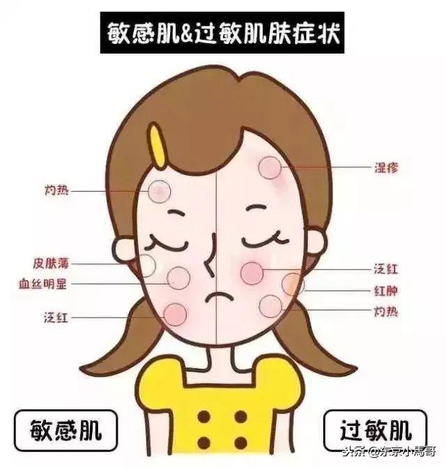 敏感肌有救了！日本超人气的敏感肌肤护理品牌MINON，孕妇可用！