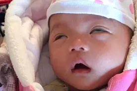 宝宝睡着后直翻白眼，吓得宝爸连夜开车去医院，医生解释完尴尬了图片