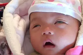 宝宝睡着后直翻白眼，吓得宝爸连夜开车去医院，医生解释完尴尬了图片