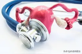 检查发现盆腔积液就是盆腔炎？其中区别你要知道图片