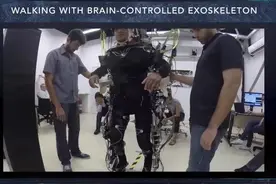 人兽杂交器官移植？这些研究有些科幻图片