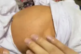 “他没吃饱他要哭！”宝宝一哭只知道塞奶，新生宝宝被喂出肠梗阻图片