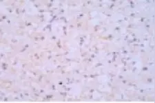 电针干预脊髓损伤大鼠受损节段缺氧诱导因子1α、血管内皮生长因子的表达图片