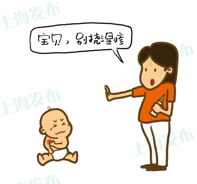 角化性湿疹传染么