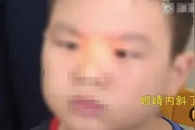 5岁男孩整天玩手机，玩成了“斗鸡眼”，管理电子保姆刻不容缓图片