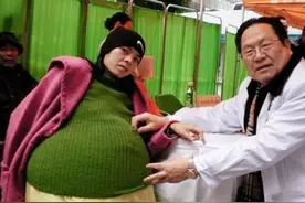 广东“巨腹女人”彭细妹：她的真实遭遇让人动容图片