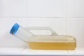 糖尿病泡沫尿时有时无，就是肾脏已受损？辟谣：不如做好这4件事图片