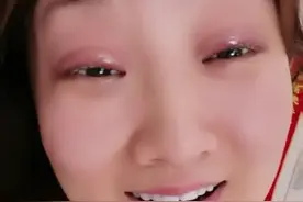 乡爱王云称整容失败，晒近况眼皮红肿超显眼，哭笑不得疑疼痛难忍图片