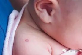 预防肺结核的卡介苗可降低新冠感染？以色列大样本研究：无效图片