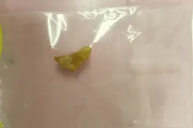 1岁多宝宝误吞花生米窒息，出租车司机连闯三个红灯送院，孩子救回来了，司机目前没收到罚单图片