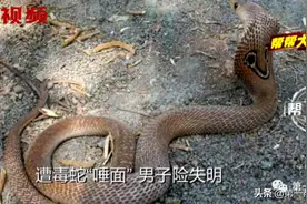 男子遭毒蛇攻击，眼睛被毒液喷射，幸好这个举动救了他图片
