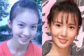 金晨的脸，究竟是从什么时候开始变的？图片