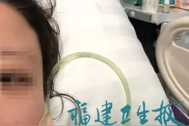 惊险！福建36岁女子突发腹痛住进ICU！被救回后自述：中西医结合治疗救了我的命图片