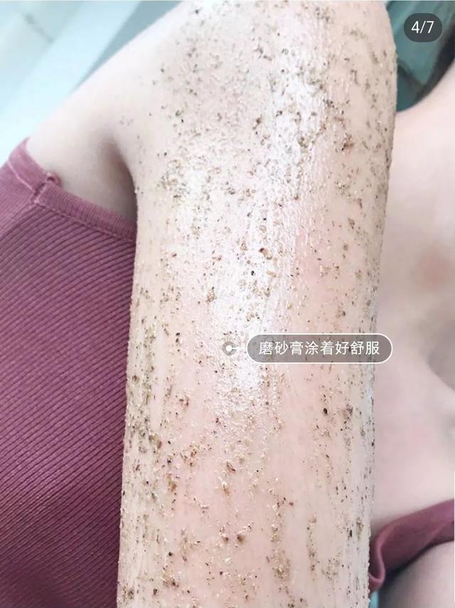 鸡皮肤腿上的红点要怎么治疗