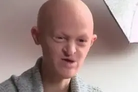 她因长相酷似外星人，从小就被嘲笑，不料多年后成为世界级大模特图片