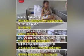 6岁女孩鼻子里“长牙”，只因摔倒后一个动作图片