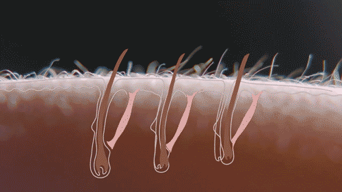 身上起一块一块的鸡皮疙瘩一样的是什么原因