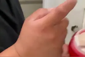 说谎的代价！河北一男子以为妻子的面霜很便宜，对着脸一顿涂图片