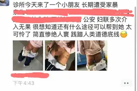 鞭子打、火钳烫？老师上课发现女孩衣服渗血…不敢相信这是亲妈干的事图片