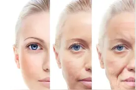 面部拉皮手术后遗症有哪些？科普可能出现的情况，医美不怕坑图片