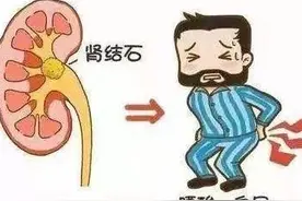 预防肾结石，这几个问题你知道吗图片