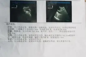 从确诊到死亡仅一年！医生坦白：胰腺癌“偏爱”6种人，请重视图片