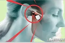 【携手康复】张口时腮帮子作响，也需要治疗图片