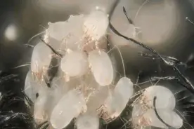 从鼻子上挤出来的白色物质，到底是什么？告诉你答案和处理办法图片