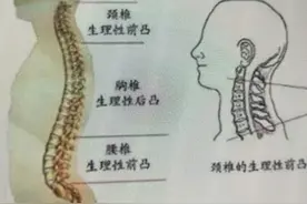 顽固颈椎病，只需坚持日常两个方法，颈椎康复如初。图片